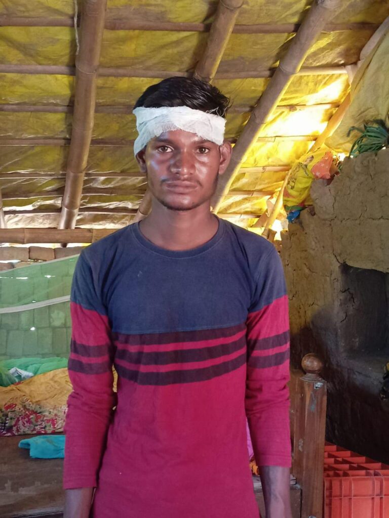 टीबी के लक्षण दिखे तो जाएं नजदीकी सरकारी अस्पताल