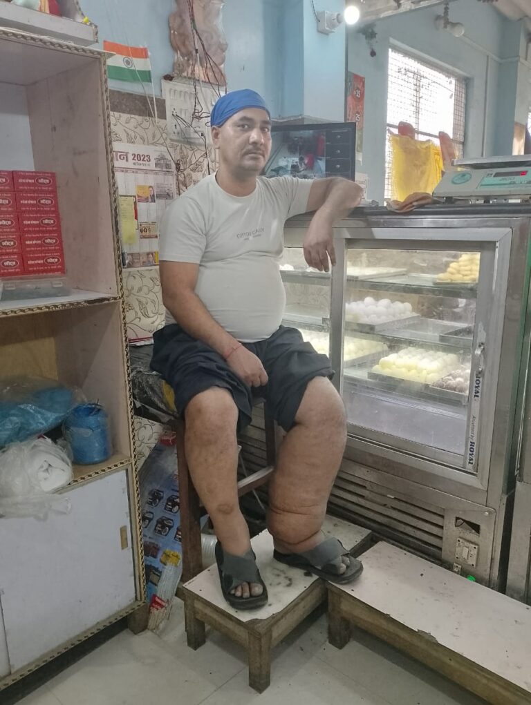 हमसे से जो हुई भूल उसे आप लोग नहीं दुहराएं-स्वास्थ्य कर्मियों के सामने ही फाइलेरिया की दवा जरूर खाएं : चंदन कुमार 